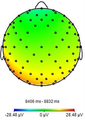 Simultaneous EEG-fMRI for Functional Neurological Assessment